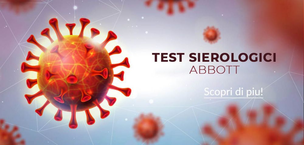 test sierologici abbott coronavirus